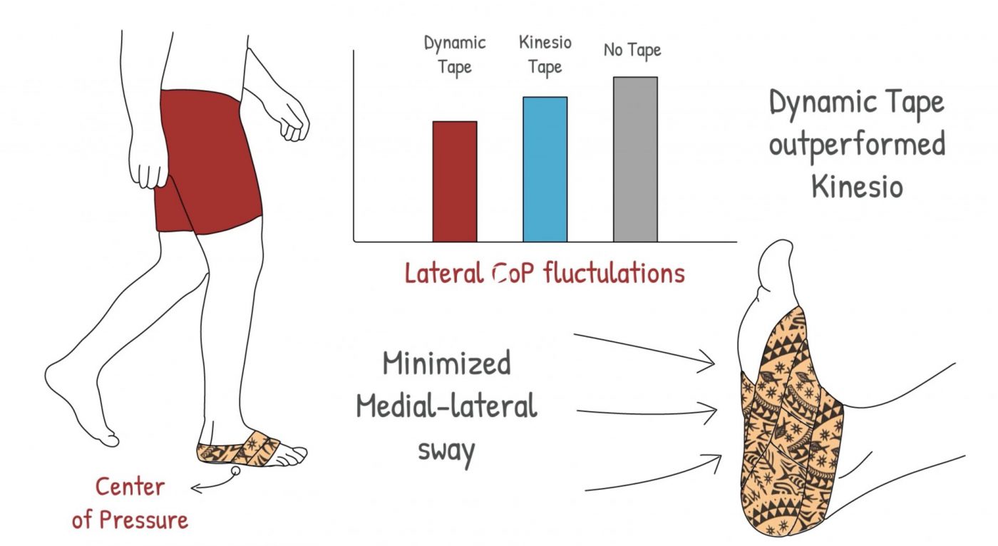 Kinesio vs. Dynamic Tape