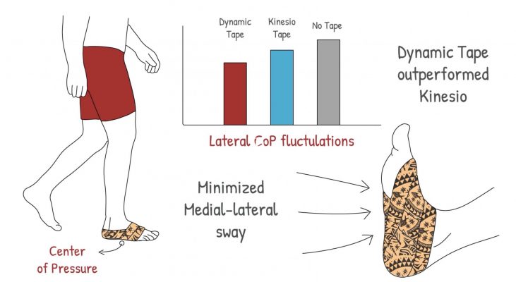 Kinesio vs. Dynamic Tape